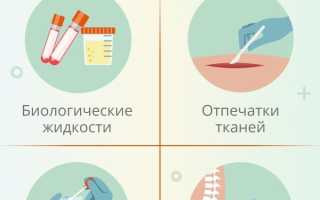 Мазок на онкоцитологию. Что это, норма, расшифровка, когда сдавать, как подготовиться, сколько делается