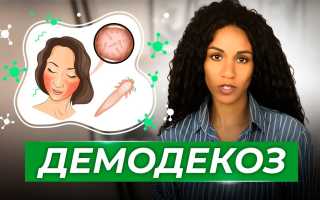 Демодекоз на лице у человека. Схема лечения, препараты, народные средства
