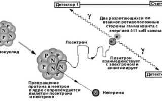 ПЭТ КТ. Что это за исследование, отзывы пациентов, цена