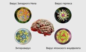 Последствия клещевого энцефалита головного мозга