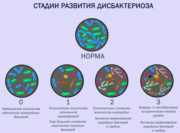 Анализ на чувствительность к бактериофагам, дисбактериоз кишечника. Расшифровка