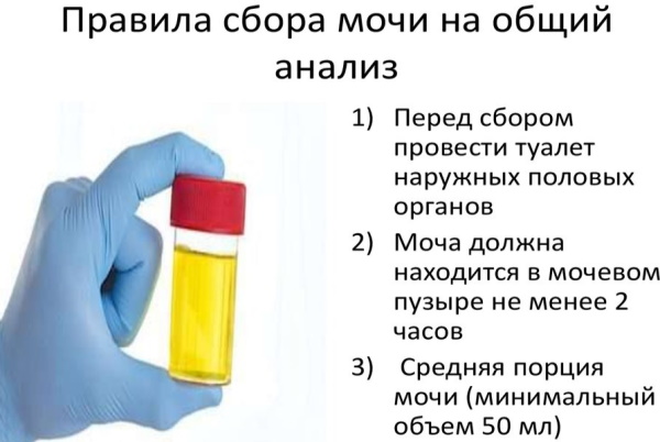 Белок в моче у ребенка. Что это значит, норма, повышен, причины