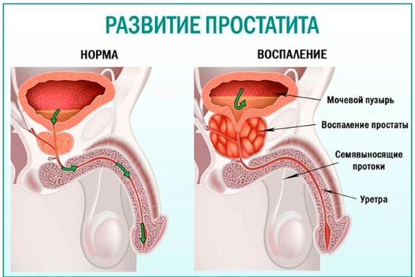Бобровая струя. Лечебные свойства, показания к применению, как приготовить и принимать