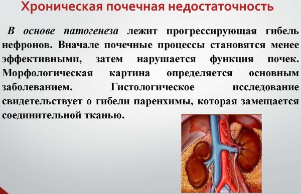 Болит почка с левой стороны. Что это может быть, причины, симптомы и лечение