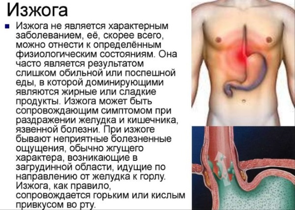 Что помогает от изжоги: медикаментозное лечение, народные средства и методы в домашних условиях