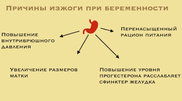 Что помогает от изжоги: медикаментозное лечение, народные средства и методы в домашних условиях