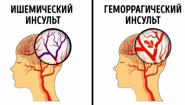 Норма атмосферного давления для человека в паскалях. Давление ртутного столба.