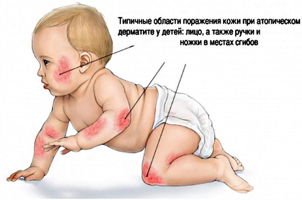 Рела Лайф (Rela Life) для новорожденных. Инструкция по применению, аналоги, цена