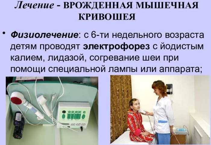 Электрофорез для грудничков на шею. Отзывы