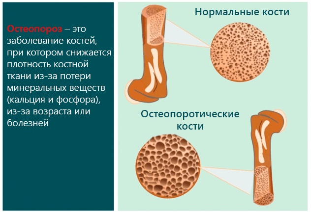 Фосфор в продуктах питания. Таблица, где больше всего, суточная норма, польза, вред