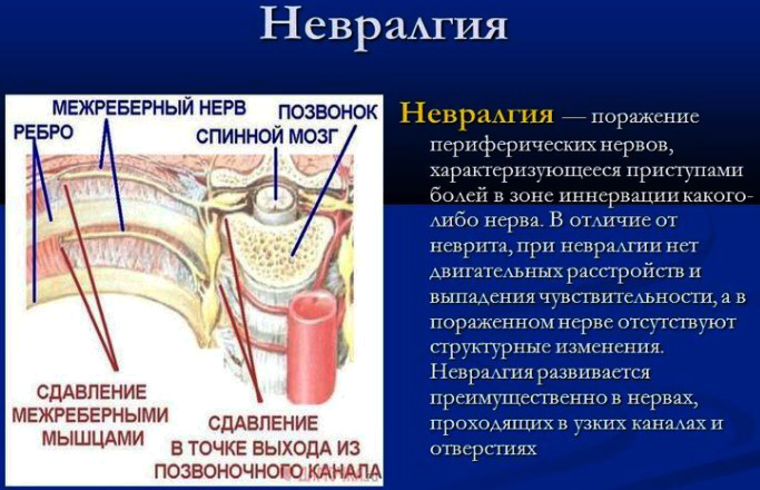 Финлепсин. Инструкция по применению, отзывы пациентов, цена