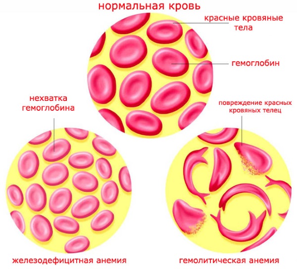 Моноциты, норма у женщин по возрасту. Таблица, что значит повышенные, причины, анализ