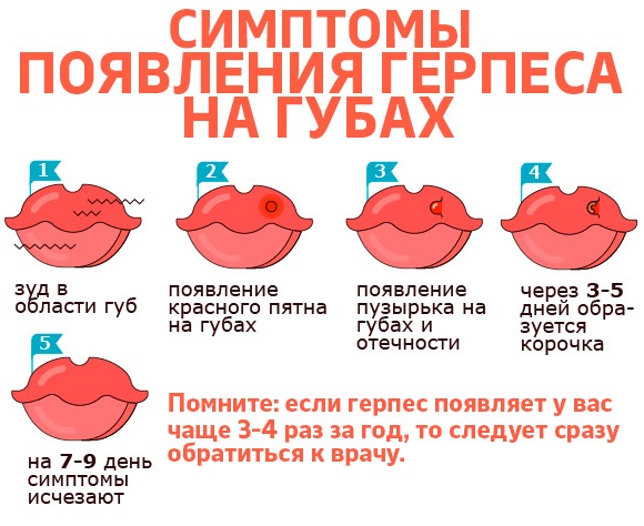 Болезни, передающиеся через поцелуй, слюну. Список