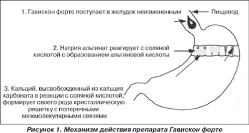 Гевискон (Gaviscon) для беременных. Цена, инструкция по применению таблеток, суспензии