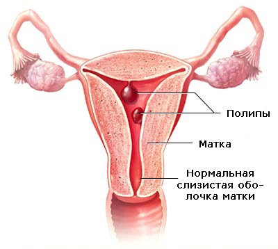 Хмель шишки. Полезные, лечебные свойства и противопоказания для женщин, мужчин, детей. Когда собирать и как использовать растение в домашних условиях