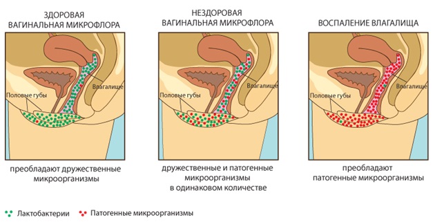 Хмель шишки. Полезные, лечебные свойства и противопоказания для женщин, мужчин, детей. Когда собирать и как использовать растение в домашних условиях