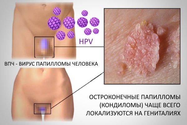 Индинол Форто. Отзывы женщин, принимавших препарат, состав, аналоги