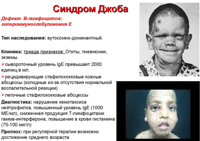 Иммуноглобулин Е повышен у ребенка. Причины, что это