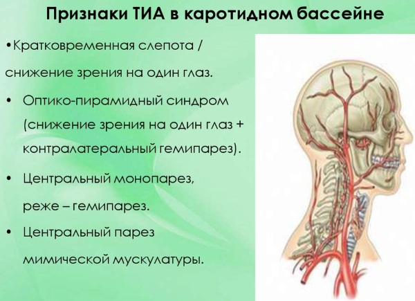 Транзиторная ишемическая атака. Что это такое, причины, симптомы, лечение