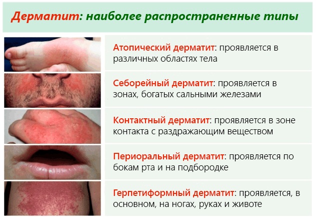 ЭНМГ нижних/верхних конечностей. Что это такое, цена обследования, как делают
