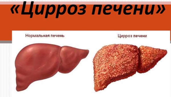 Боль в правом подреберье спереди. Причины, возможные заболевания. Лечение, диагностика