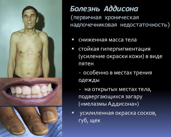 Калийсберегающие диуретики последнего поколения. Что это такое, список препаратов, механизм действия
