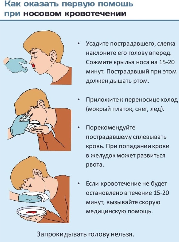 Капиллярное кровотечение. Как остановить: способы, алгоритм, первая помощь. Отличия от венозного