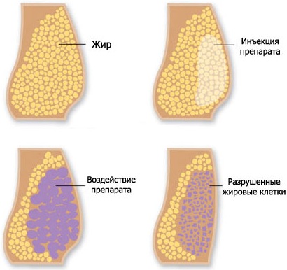 Эффективные капсулы для похудения. Рейтинг, отзывы