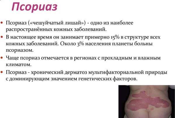 Китайские мази от псориаза негормональные, на Алиэкспресс. Фото, какие купить, применение