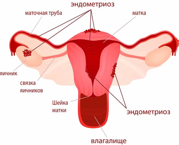 Cтелла таблетки для женщин. Инструкция, для чего они нужны, аналоги, цена