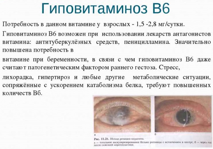 Комбилипен (Combilipen) в таблетках. Цена, инструкция по применению, аналоги, состав