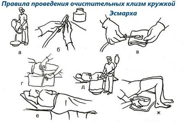 Прием у проктолога. Как проходит у женщин, мужчин, как подготовиться