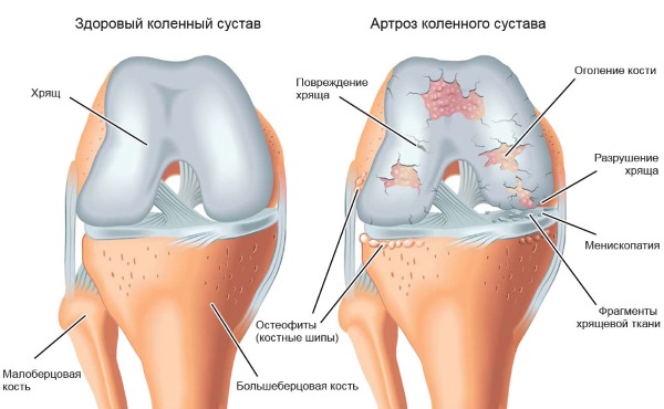 Лечебные свойства овса, как правильно сделать отвар, квас. Рецепты и противопоказания