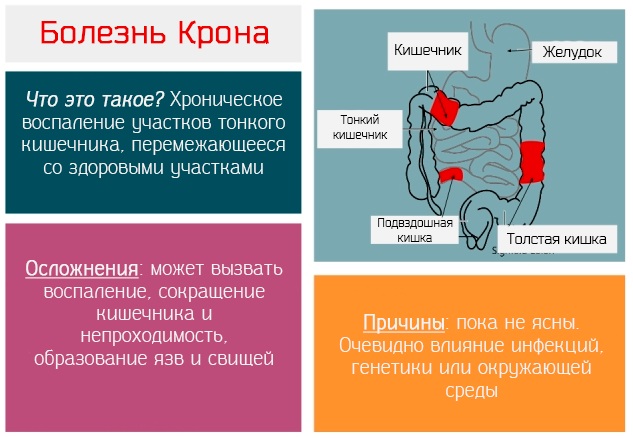 Синдром мальабсорбции. Что это у детей, взрослых, симптомы, рекомендации, лечение