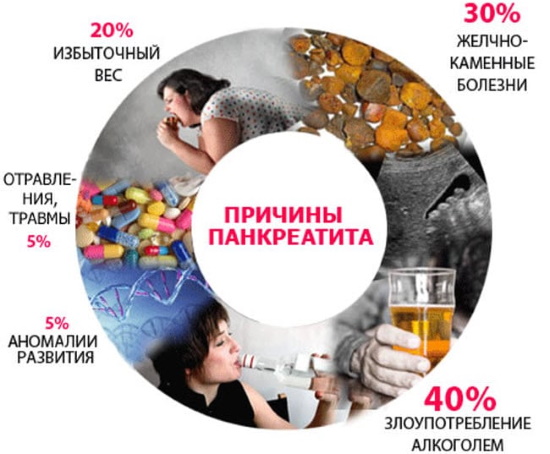 Лечение панкреатита у взрослых медикаментами, препараты для капельницы, травы, диета