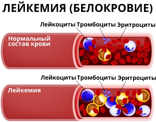 Состав крови человека, таблица. Анатомия, физиология