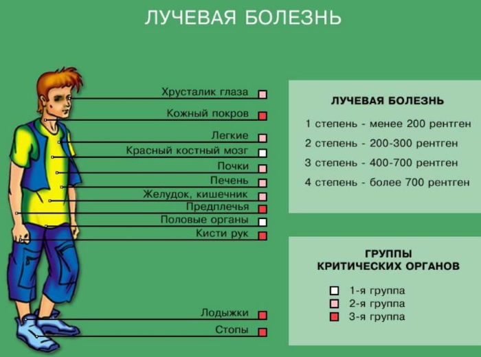 Лучевая болезнь. Симптомы, стадии, степени тяжести, лечение