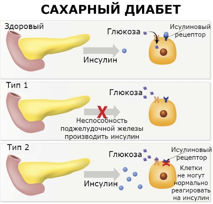 Масло расторопши. Полезные свойства, противопоказания, как принимать