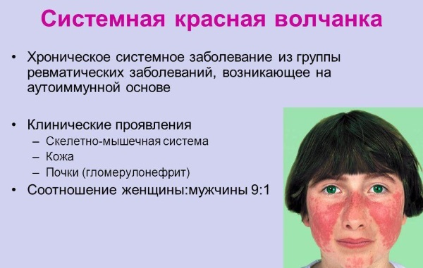 Мази от дерматита и кожных заболеваний на лице, руках, ногах. Список негормональных, цены
