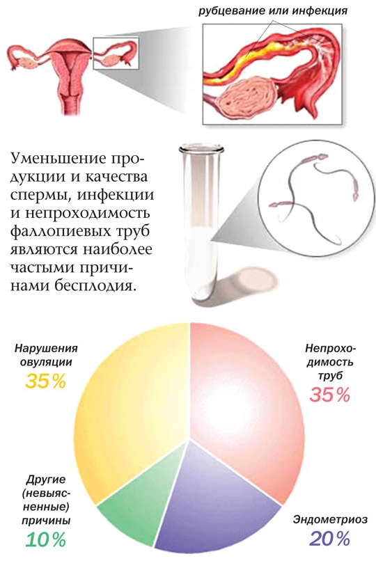 Менопур (Menopur). Отзывы при стимуляции ЭКО, овуляции, инструкция по применению
