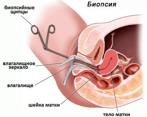Месячные при климаксе. Как идут, сколько, симптомы, как вызвать, восстановить