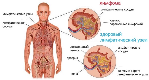 Метилурацил мазь. Инструкция по применению в гинекологии, стоматологии, проктологии, косметологии. Цена, аналоги, отзывы