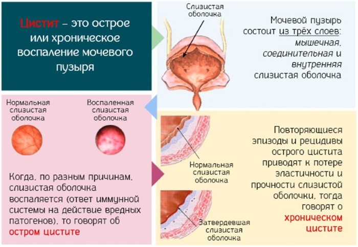Молоко с прополисом на ночь. Польза, рецепт от кашля, при панкреатите, для поджелудочной железы, желудка, иммунитета