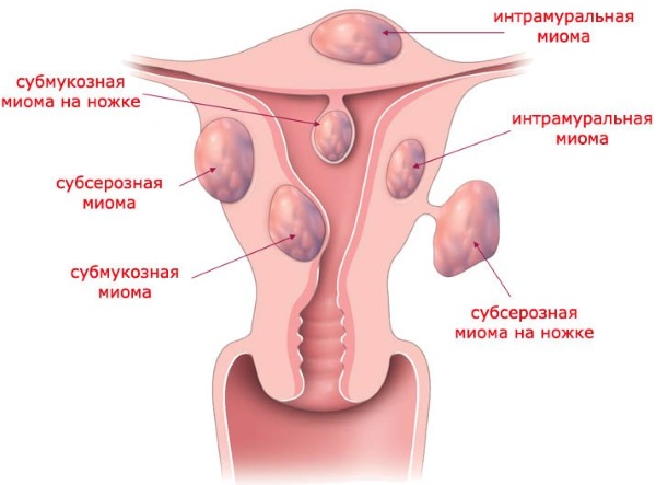 Молоко с прополисом на ночь. Польза, рецепт от кашля, при панкреатите, для поджелудочной железы, желудка, иммунитета