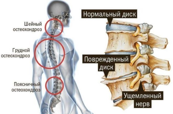 Нанопластырь Нанопласт Форте. Инструкция по применению. Цена, аналоги