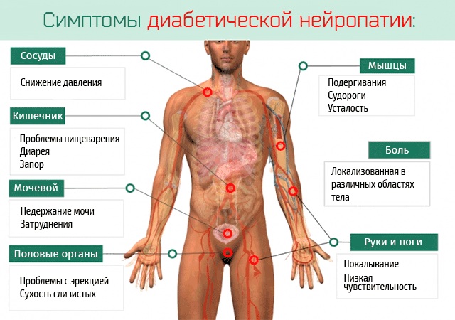 Тиоктацид (Thioctacid) 600 таблетки. Цена, инструкция, аналоги