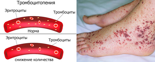 Но-шпалгин (No-spalgin). Инструкция по применению, показания, цена, отзывы, аналоги