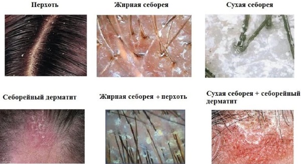Очанка - лечебные свойства и противопоказания, состав, польза и вред. Особенности применения в народной медицине и косметологии