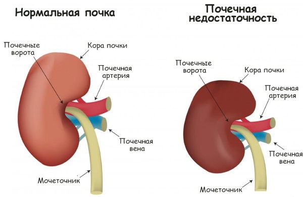 Термикон мазь. Инструкция по применению, цена, аналоги, отзывы