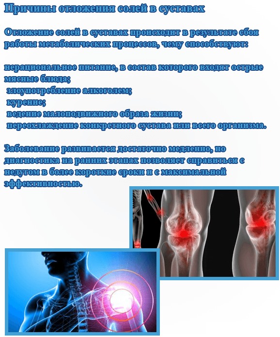 Отложение солей на шее. Фото, как избавиться, лечение
